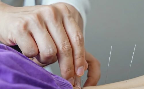 acupuntura.jpg